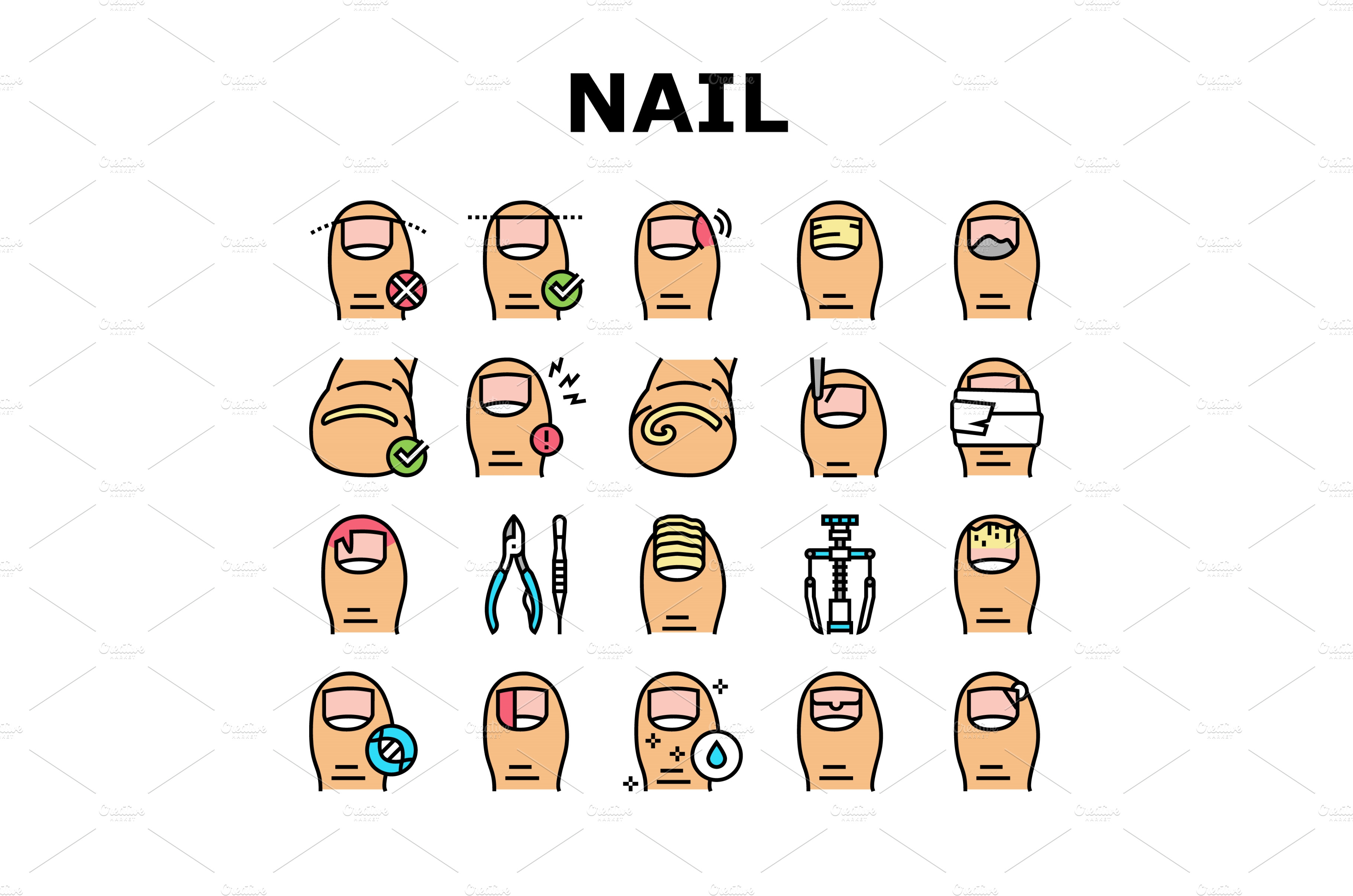 ingrown-nail-disease-collection-industrial-stock-photos-creative-market