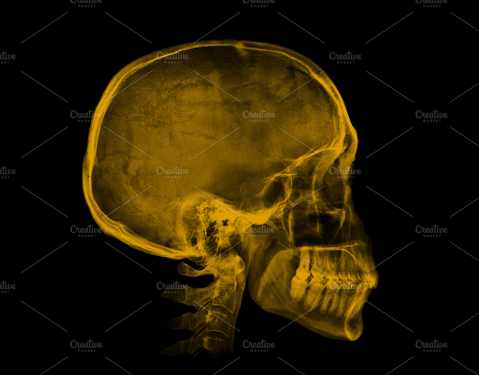 Human skull. Yellow X-ray image on black background | Graphic Objects ...