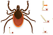 Tick removal infographic elements | Healthcare Illustrations ~ Creative ...