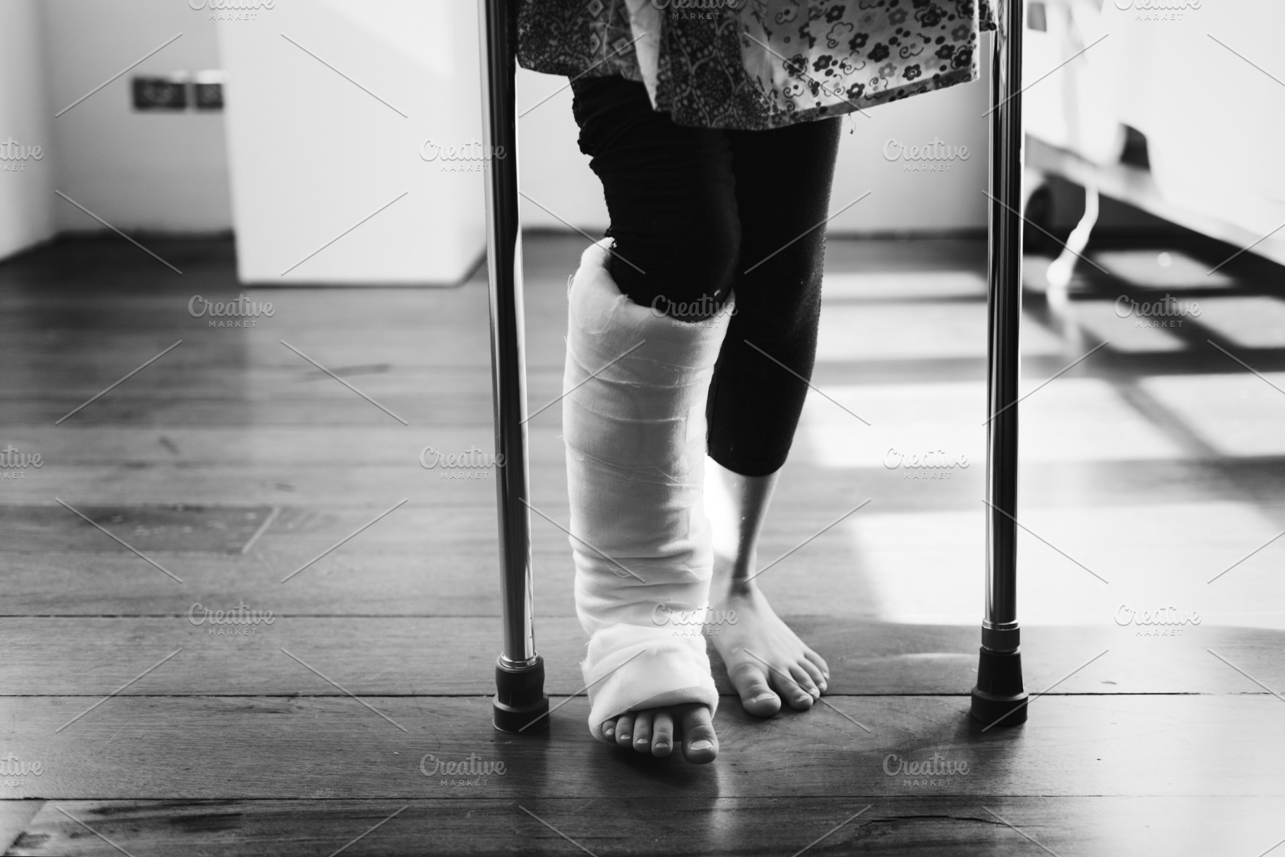 young-girl-with-a-broken-leg-featuring-accident-black-and-white-and